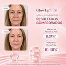 Máscara de Colágeno PDRN de Salmão - GlowUp™