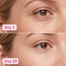 Comparação de antes e depois do uso da Bio Glass: pele ao redor dos olhos no Dia 1 e no Dia 29, mostrando linhas finas com aparência suavizada