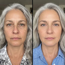 Foto de antes e depois enviada pela cliente Clara Medeiros no depoimento sobre a Bio Glass, mostrando a pele do rosto mais hidratada