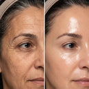 Foto de antes e depois enviada pela cliente Renata Vasconcelos no depoimento sobre a Bio Glass, mostrando a textura da pele mais uniforme